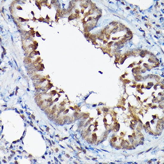 Anti-GSK3Beta Antibody (CAB11360)