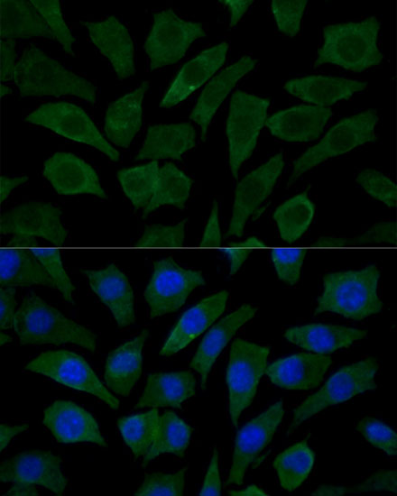 Anti-COX15 Antibody (CAB14665)