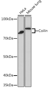Anti-Coilin Antibody (CAB3483)