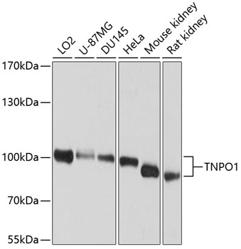 Anti-Transportin-1 Polyclonal Antibody (CAB9435)