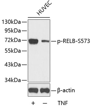 Anti-Phospho-RELB-S573 Antibody (CABP0240)