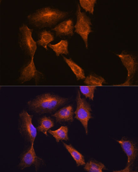 Anti-HOOK3 Antibody (CAB15536)