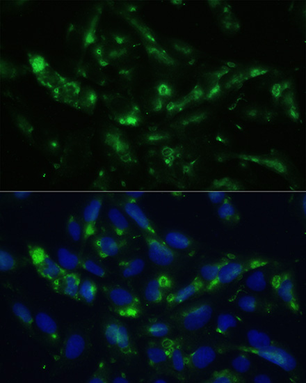 Anti-CGRP Antibody (CAB5542)