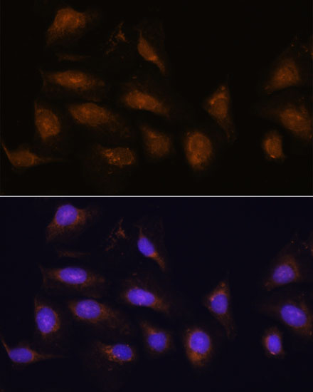 Anti-P90RSK Antibody (CAB15718)