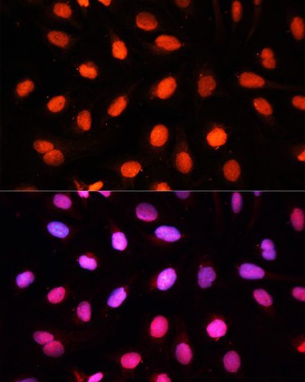 Anti-NSUN2 Antibody (CAB3443)