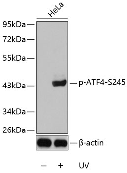 Anti-Phospho-ATF4-S245 Antibody (CABP0309)