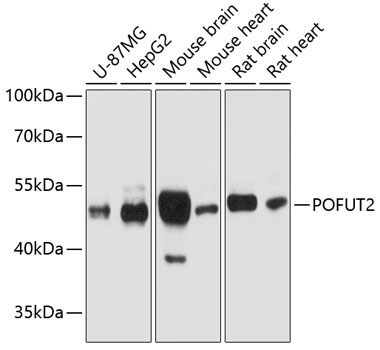 Anti-POFUT2 Antibody (CAB12223)