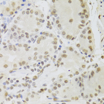 Anti-RUVBL1 Antibody (CAB5723)