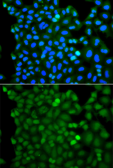 Anti-RNF125 Polyclonal Antibody (CAB7982)