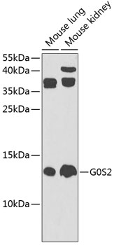 Anti-G0S2 Polyclonal Antibody (CAB9970)