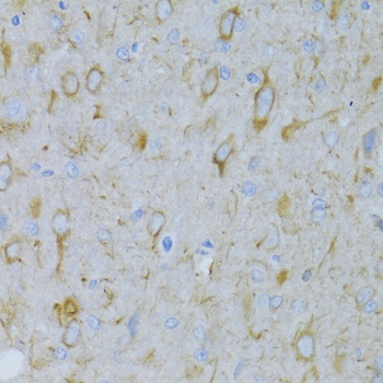 Anti-Alpha-Tubulin Antibody (CABC014)