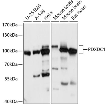 Anti-PDXDC1 Antibody (CAB14856)