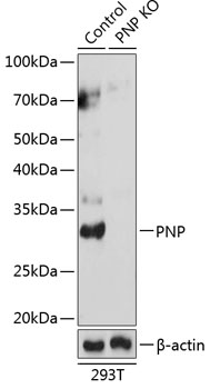 Anti-PNP Antibody [KO Validated] (CAB19885)