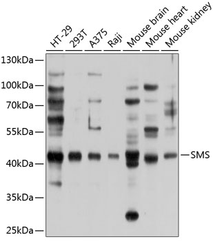 Anti-Spermine synthase Polyclonal Antibody (CAB9154)