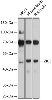 Anti-ZIC3 Polyclonal Antibody (CAB9476)