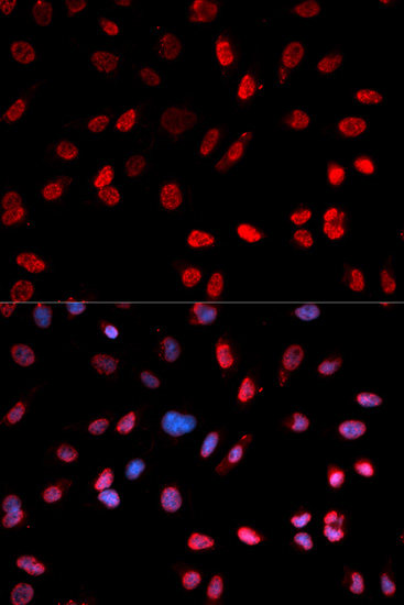 Anti-Phospho-ATF2-T71 Antibody (CABP0020)