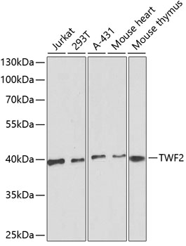 Anti-TWF2 Antibody (CAB13642)