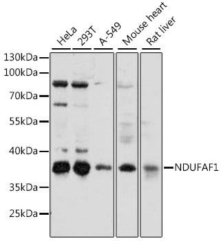 Anti-NDUFAF1 Antibody (CAB15835)