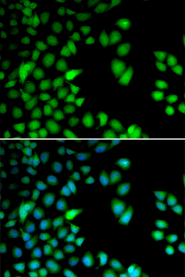 Anti-RPS6KA3 Antibody (CAB5436)