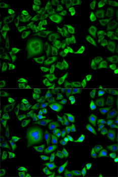 Anti-EXT1 Antibody (CAB2030)