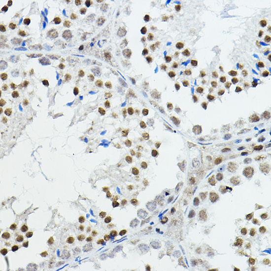 Anti-NCOR1 Antibody (CAB7046)