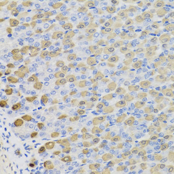 Anti-LDHB Antibody (CAB7625)