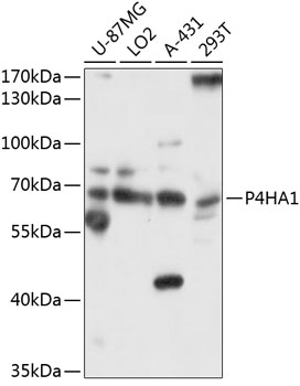 Anti-P4HA1 Antibody (CAB10538)