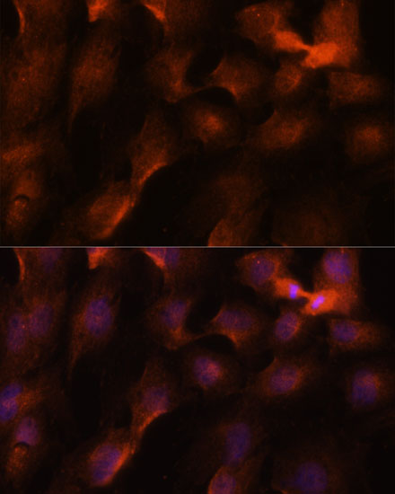 Anti-BRCA1 Antibody (CAB11034)