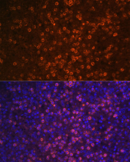 Anti-CR2 Polyclonal Antibody (CAB8407)