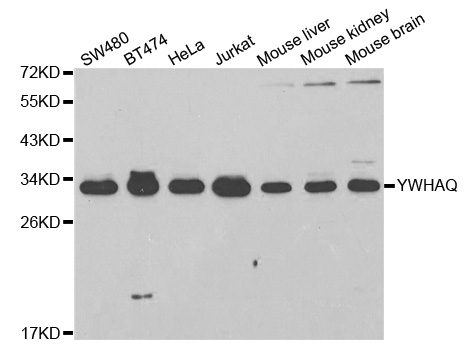 Anti-YWHAQ Antibody (CAB2563)