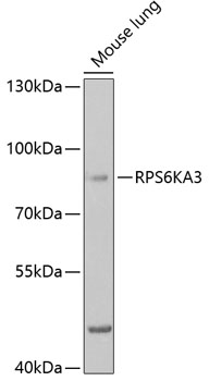 Anti-RPS6KA3 Antibody (CAB5436)