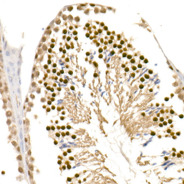 Immunohistochemistry of paraffin-embedded mouse testis using TET1 Rabbit mAb at dilution of 1:1600 (40x lens). Perform high pressure antigen retrieval with 10 mM citrate buffer pH 6. 0 before commencing with IHC staining protocol.