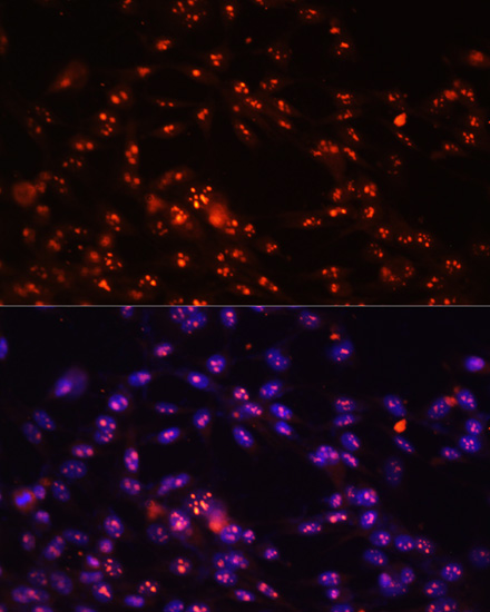 Anti-DKC1 Antibody (CAB12914)