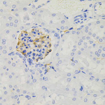 Anti-NPHS1 Antibody (CAB3048)
