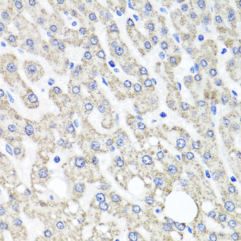 Anti-OTC Polyclonal Antibody (CAB9834)