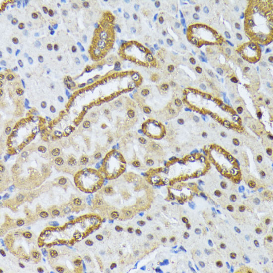 Anti-SMN1 Antibody (CAB16246)