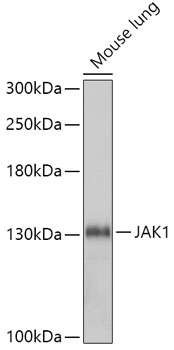 Anti-JAK1 Antibody (CAB5534)