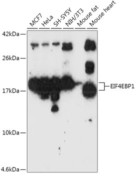 Anti-EIF4EBP1 Antibody [KO Validated] (CAB1248)