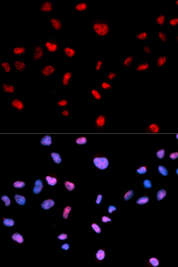 Anti-Phospho-CDK1-T161 Antibody (CABP0324)