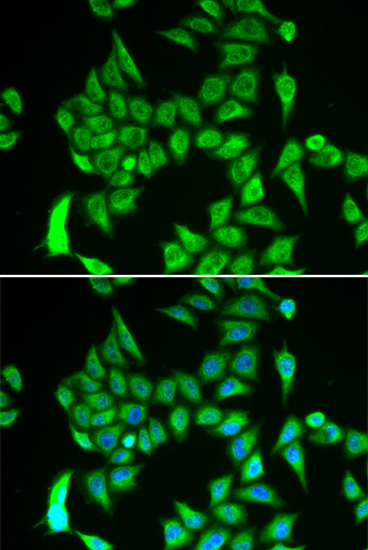 Anti-IREB2 Antibody (CAB6382)