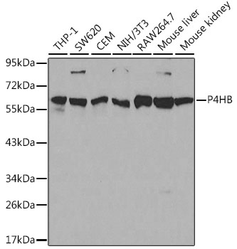 Anti-P4HB Antibody [KO Validated] (CAB0692)