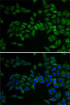 Anti-E2F6 Antibody (CAB2718)