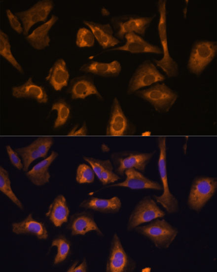 Anti-EIF5B Antibody (CAB15123)