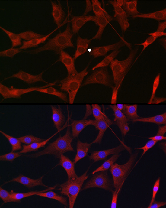 Anti-MLKL Antibody (CAB17312)