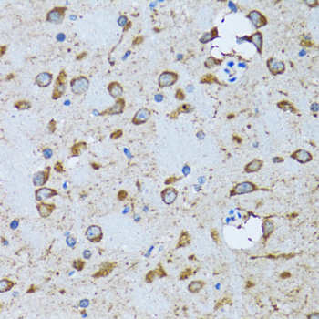 Anti-PDP1 Antibody (CAB6332)