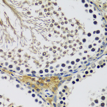 Anti-C10orf62 Antibody (CAB17284)