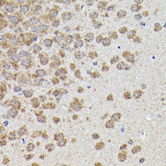 Anti-GSK3Beta Antibody (CAB11360)