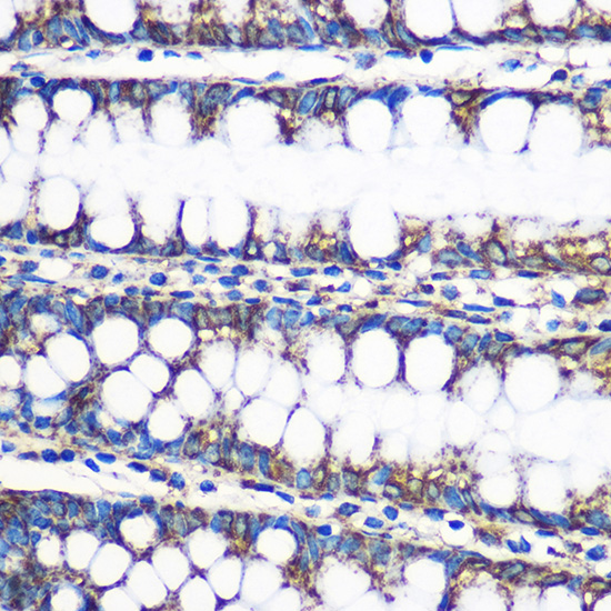 Anti-HSD17B10 Antibody (CAB5448)