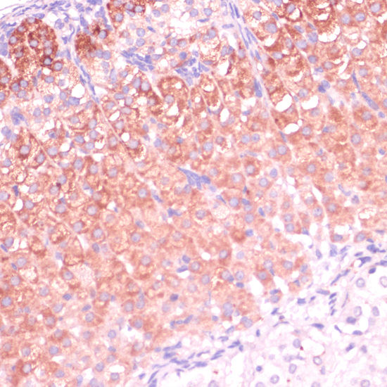 Anti-CYP11B2 Antibody (CAB1443)