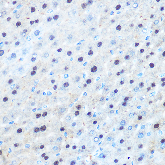 Anti-ARG1 / Arginase 1 Antibody (CAB1847)